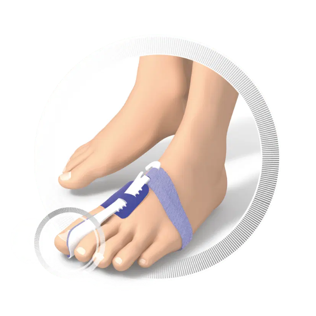 Снимка на Нощна шина за Hallux Valgus (кокалче)
