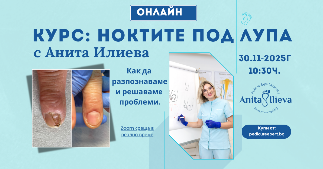 Снимка на Ноктите под лупа - Как да разпознаваме и решаваме проблеми?